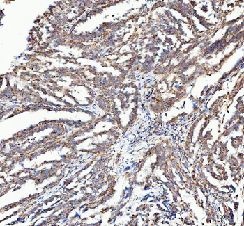 ATG7 Rabbit Polyclonal Antibody