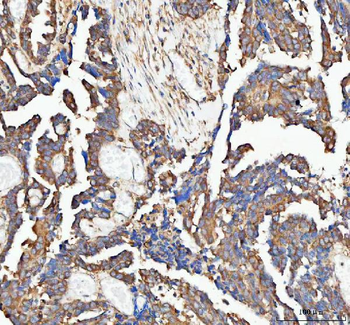 PAIP1 Rabbit Polyclonal Antibody
