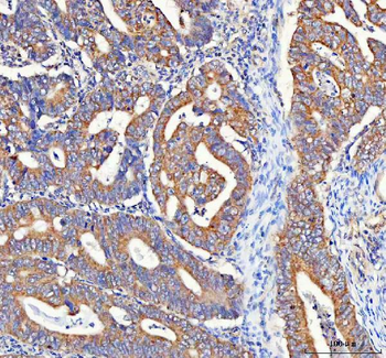 PAIP1 Rabbit Polyclonal Antibody