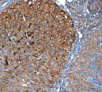 OTUB1 Rabbit Polyclonal Antibody
