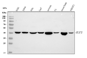 NF45/ILF2 Rabbit Polyclonal Antibody
