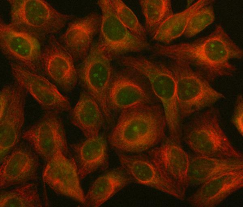 NF45/ILF2 Rabbit Polyclonal Antibody