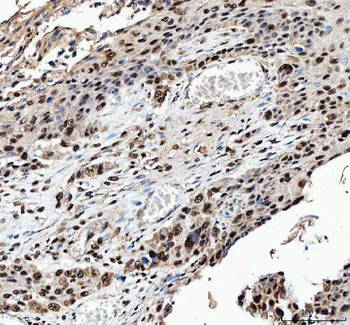 NF45/ILF2 Rabbit Polyclonal Antibody