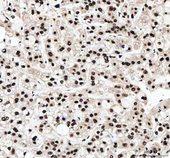 NF45/ILF2 Rabbit Polyclonal Antibody