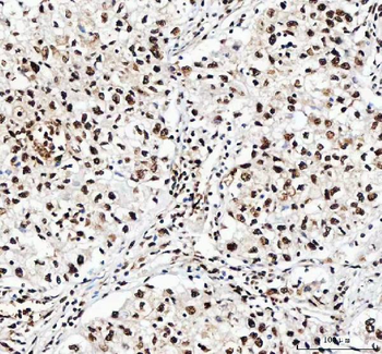 NF45/ILF2 Rabbit Polyclonal Antibody