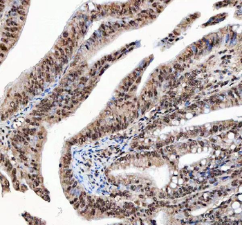 NF45/ILF2 Rabbit Polyclonal Antibody