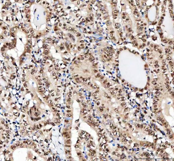 NF45/ILF2 Rabbit Polyclonal Antibody