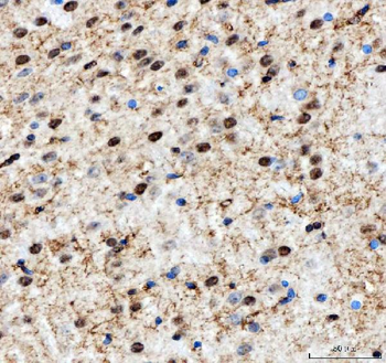NF45/ILF2 Rabbit Polyclonal Antibody