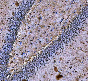 NF45/ILF2 Rabbit Polyclonal Antibody