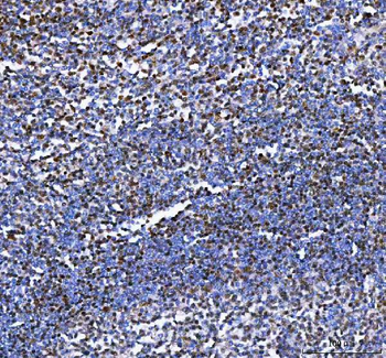 IKZF3 Rabbit Polyclonal Antibody