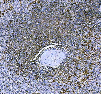 IKZF3 Rabbit Polyclonal Antibody