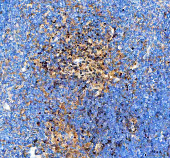 IKZF3 Rabbit Polyclonal Antibody