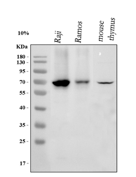 IKZF3 Rabbit Polyclonal Antibody