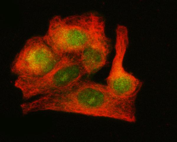 LZIC Rabbit Polyclonal Antibody