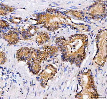 LZIC Rabbit Polyclonal Antibody
