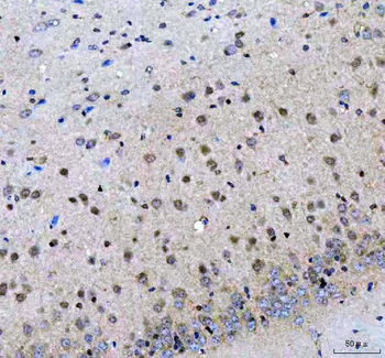 LZIC Rabbit Polyclonal Antibody