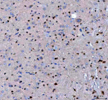 LZIC Rabbit Polyclonal Antibody