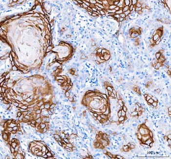 LYPD3 Rabbit Polyclonal Antibody