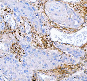 Lumican/LUM Rabbit Polyclonal Antibody