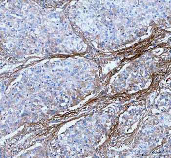 Lumican/LUM Rabbit Polyclonal Antibody