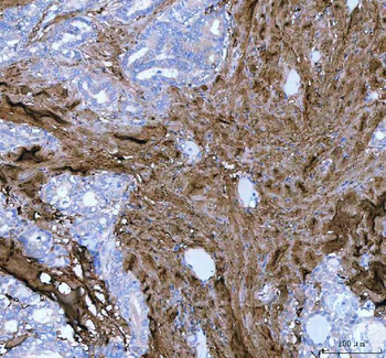 Lumican/LUM Rabbit Polyclonal Antibody