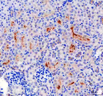 Lumican/LUM Rabbit Polyclonal Antibody