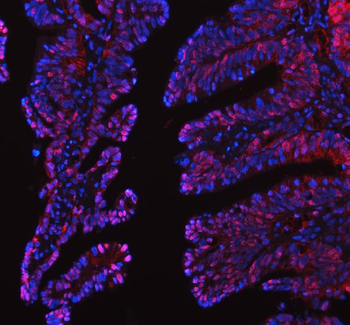 LTA4H Rabbit Polyclonal Antibody