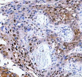 LTA4H Rabbit Polyclonal Antibody