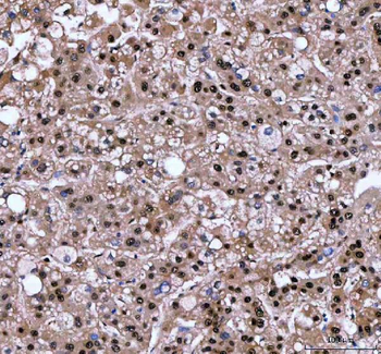 LTA4H Rabbit Polyclonal Antibody
