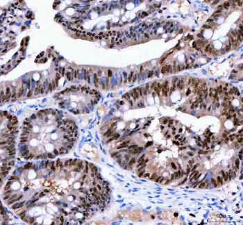 LTA4H Rabbit Polyclonal Antibody