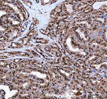 LTA4H Rabbit Polyclonal Antibody