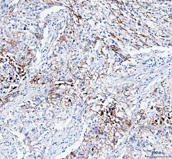 PALM Rabbit Polyclonal Antibody