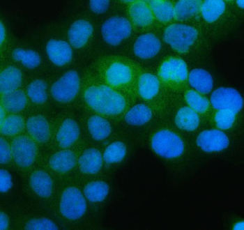 PGD Rabbit Polyclonal Antibody