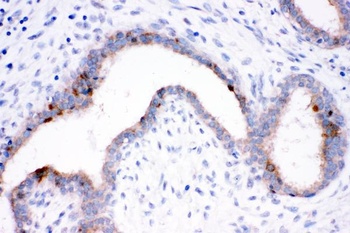 HSP70 Hspa1b Mouse Monoclonal Antibody