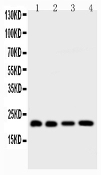 BID Rabbit Polyclonal Antibody