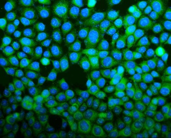 BID Rabbit Polyclonal Antibody