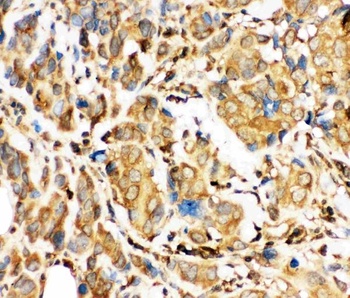 BID Rabbit Polyclonal Antibody