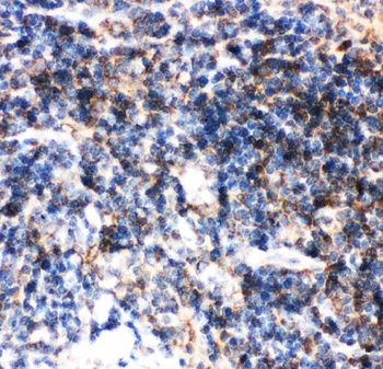BID Rabbit Polyclonal Antibody