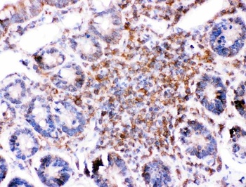 BID Rabbit Polyclonal Antibody