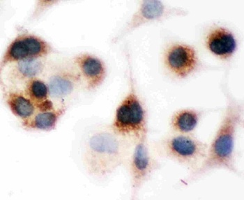 BID Rabbit Polyclonal Antibody