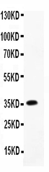 MCP3/CCL7 Rabbit Polyclonal Antibody
