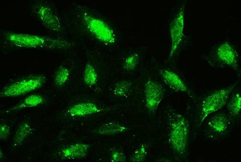 Cofilin/CFL1 Rabbit Polyclonal Antibody