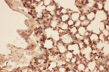 Cofilin/CFL1 Rabbit Polyclonal Antibody