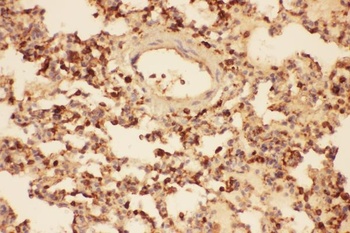 Cofilin/CFL1 Rabbit Polyclonal Antibody
