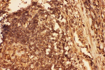Cofilin/CFL1 Rabbit Polyclonal Antibody