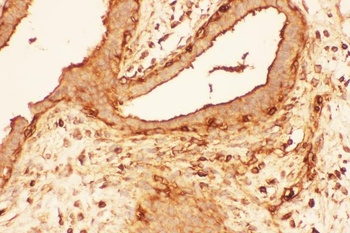 Cofilin/CFL1 Rabbit Polyclonal Antibody