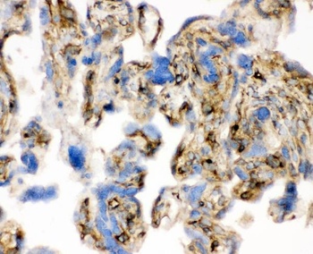 Cofilin/CFL1 Rabbit Polyclonal Antibody
