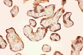 LIF Rabbit Polyclonal Antibody