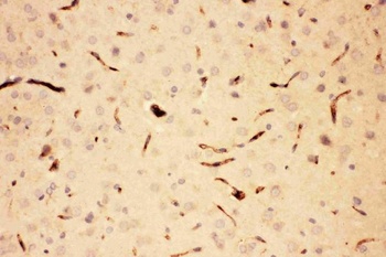 ACTH/POMC Rabbit Polyclonal Antibody