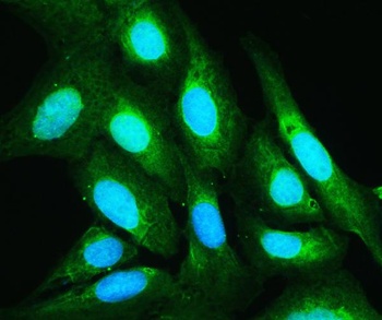 Annexin V/ANXA5 Rabbit Polyclonal Antibody